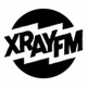 XRAY.fm - KXRY logo